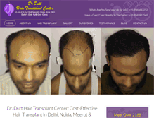 Tablet Screenshot of drdutthairtransplant.com